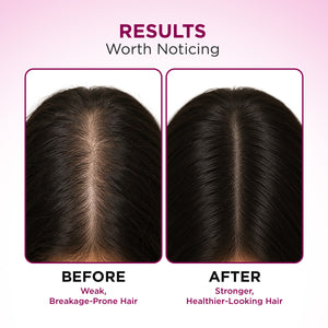 Hair Fall Control Conditioner for Stronger Hair - 250 g